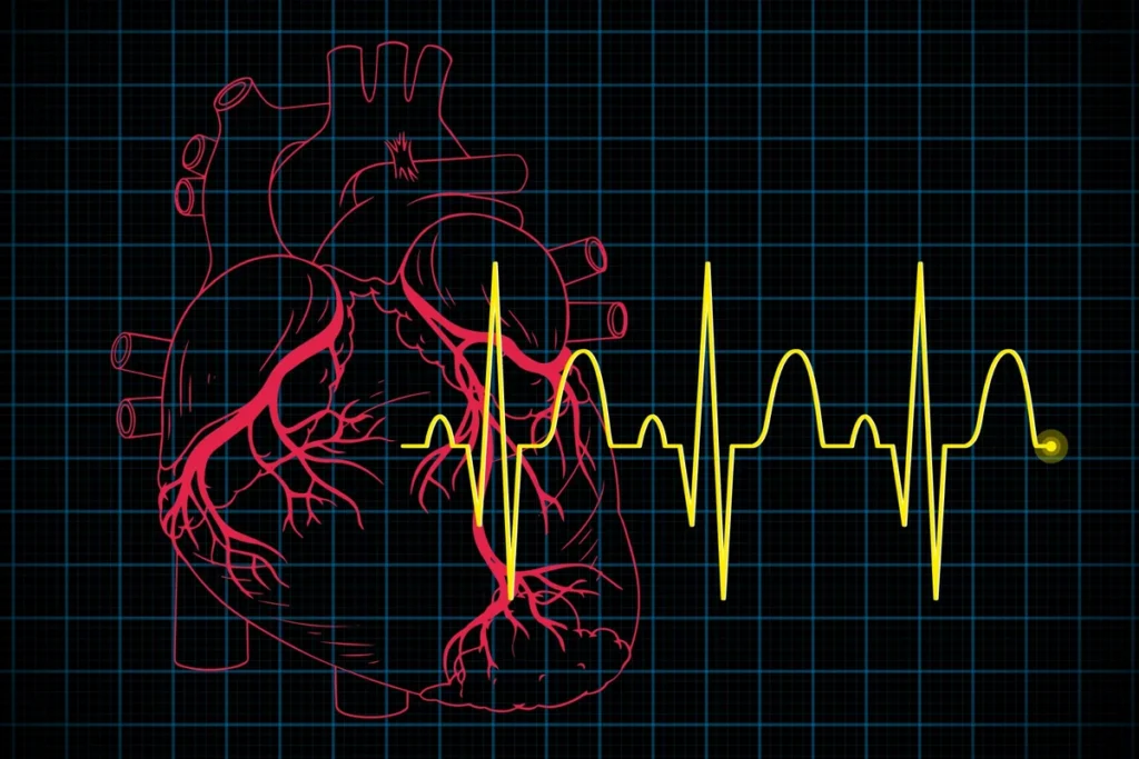 Što učiniti i kako smiriti aritmiju srca