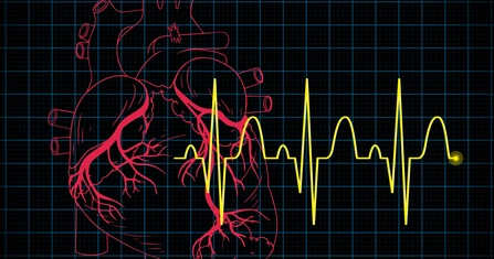 Kako smiriti aritmiju srca