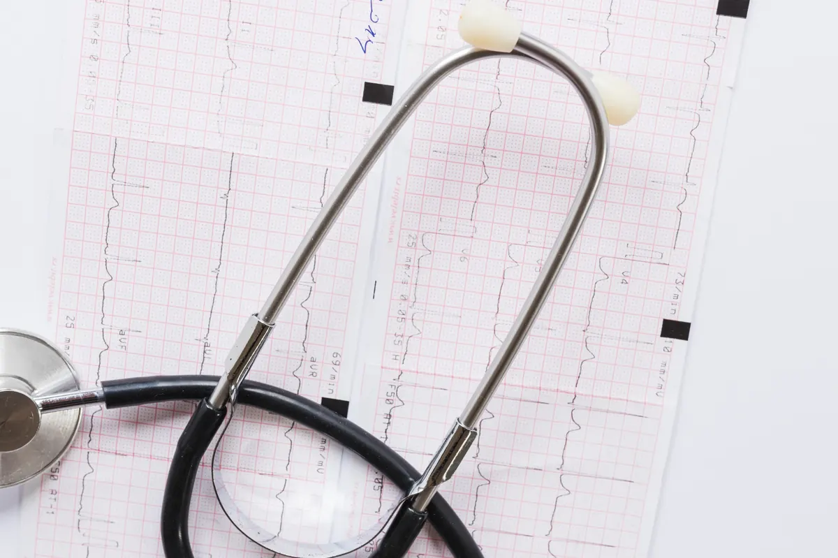 supraventrikularna tahikardija