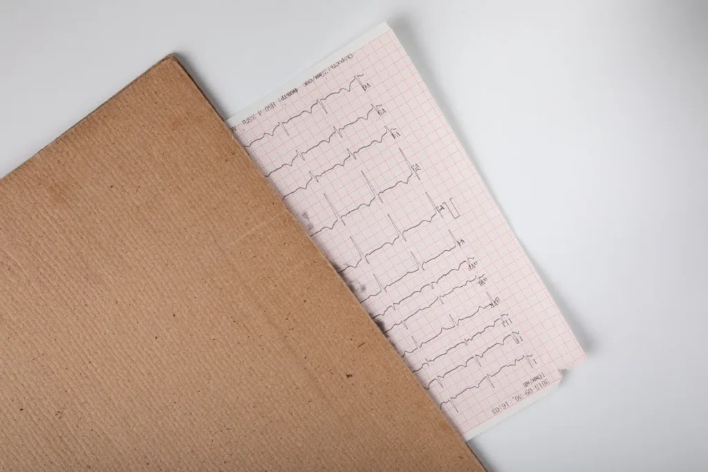 Što ako vam srce ubrzano kuca